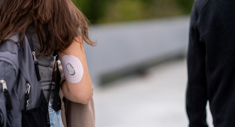 CGM Dexcom On An Arm